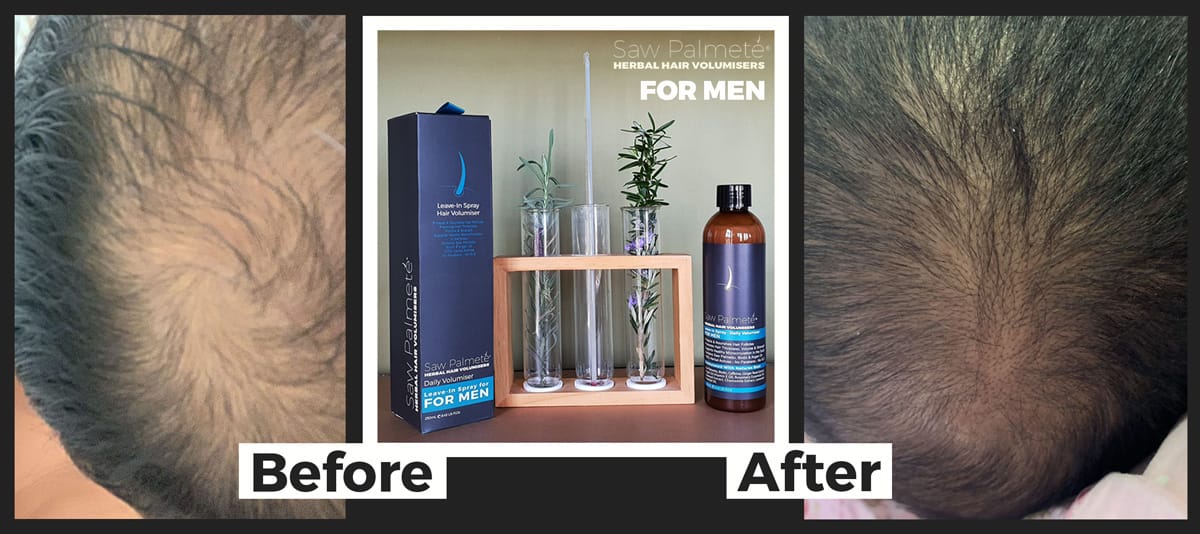 Before-&-After-Saw-Palmete4